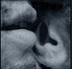 liens